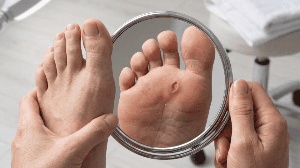 Diabetic Ulcers & Charcot Foot