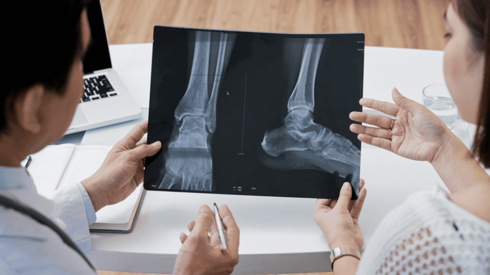 Flat Foot and Deformity Correction