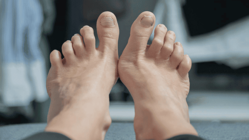 Minimally Invasive (MIS) Foot Surgery
